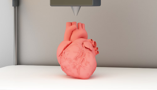 醫(yī)學(xué)3d打印重建女子頭骨 醫(yī)學(xué)3d打印重建女子頭骨